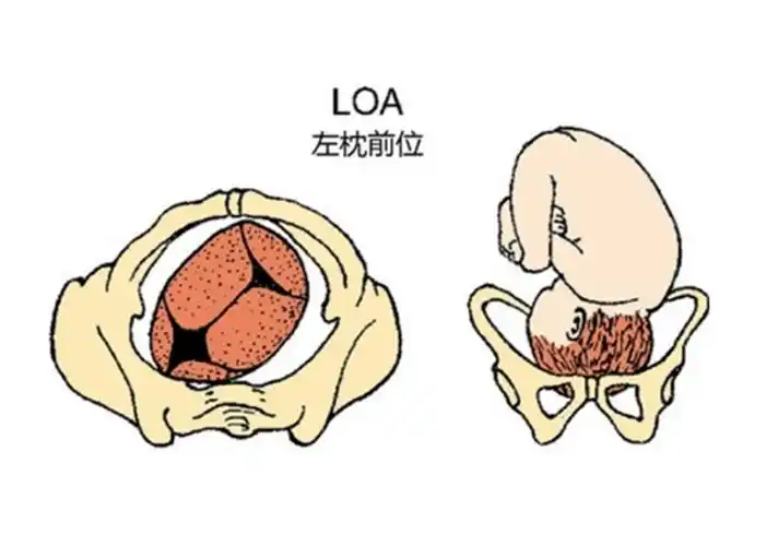 胎方位示意图_有来医生