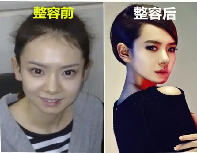 戚薇十年前照片曝光,亲口承认做了一处整容,改变巨大