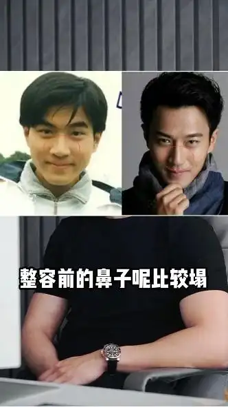 男网红不惧起诉,曝整容男星名单,还说王一博鼻子已出现挛缩现象