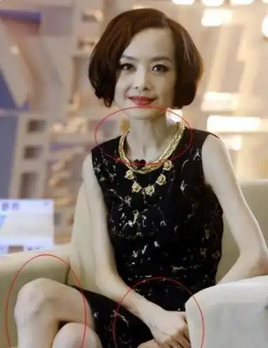 排骨胸透视装非人细腰这样的畸形审美都该改一改了