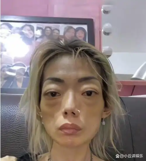 6位瘦成"纸片人"的明星,各有各的心酸,娱乐圈太"狠"了