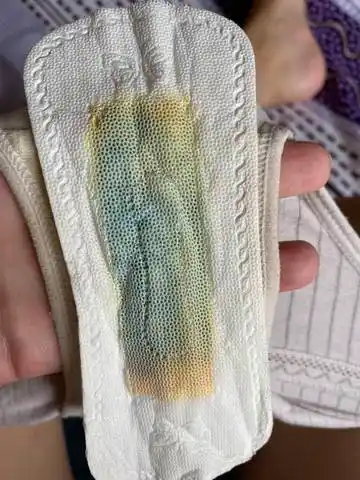 孕23周 羊水检测试纸有点蓝 不痛不痒的 这是羊水破了吗