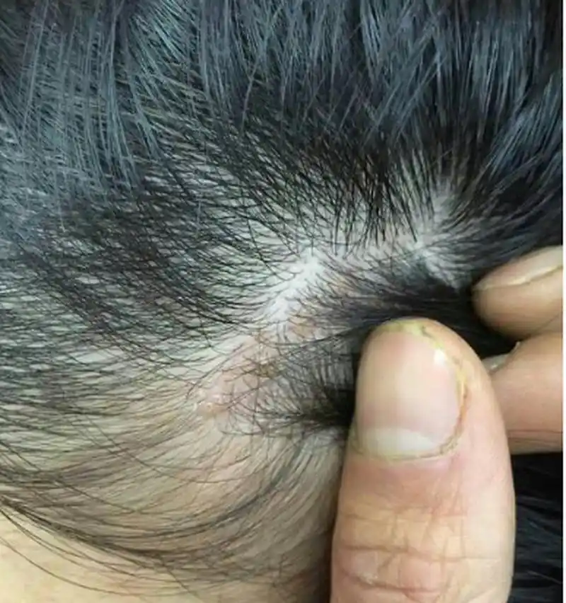 平时的熬夜工作让我头皮红疹丛生,但是这款洗发乳给了我帮助.