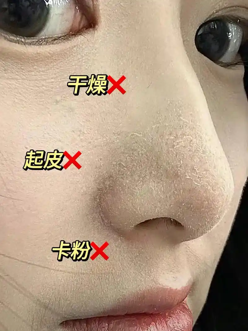 脸上起皮皮!皮肤干燥又粗糙!显得老!那你一定要试试这个!# - 抖音