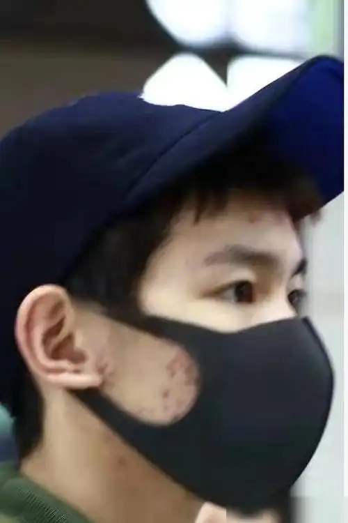 这就是王源被粉丝回踩的生图了,照片中王源虽说戴着口罩,不过依旧难以