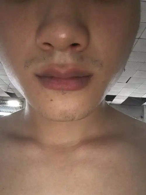 胡子稀少咋么补