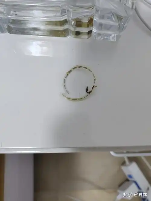 环切包皮手术大家的钛钉都是多久掉了啊,大家用盐水泡了吗?我两周才掉