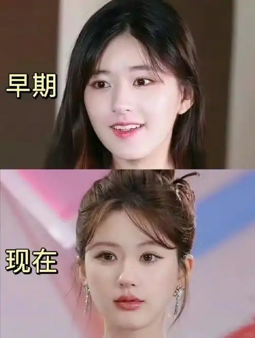 赵露思五官变化有点大啊,你喜欢她早期的面相还是现在的呢?