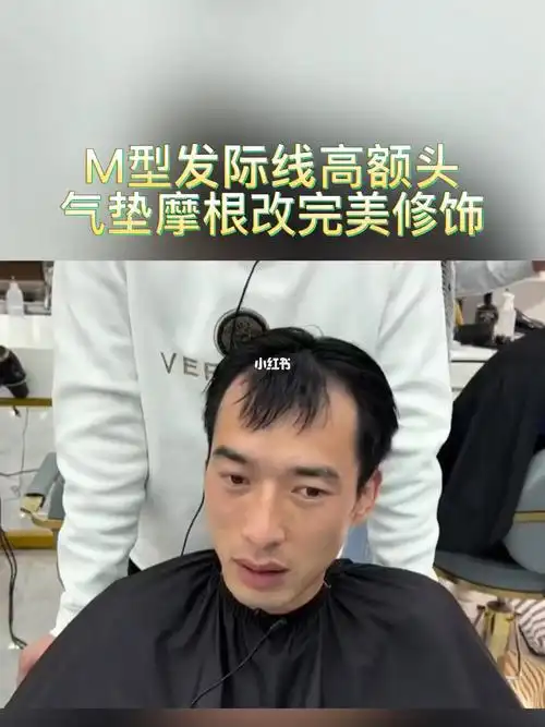 m型发际线高额头最修饰的发型