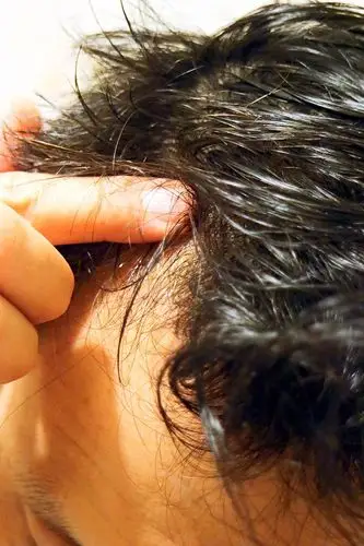 调理头皮,年轻不是梦