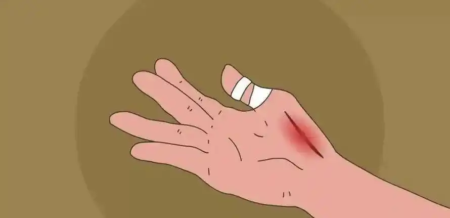 科普一分钟如何加速伤口愈合