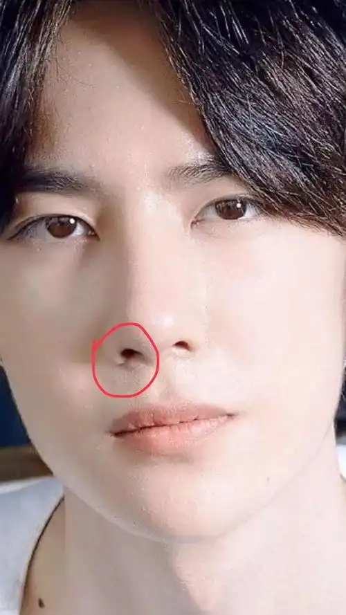 王一博疑似整容痕迹明显