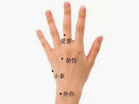 手上有痣图解 手上的痣代表什么