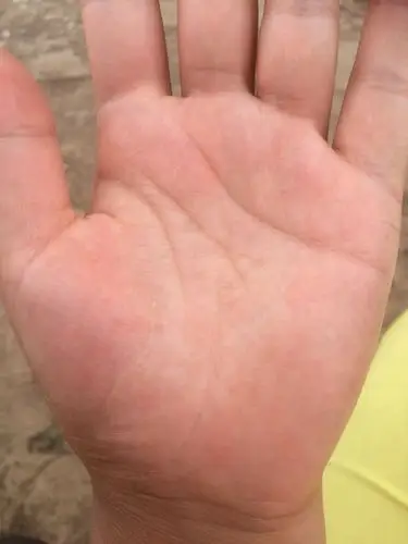 看我的手相,金星丘有三角形是什么预兆?