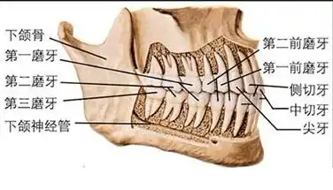 第二磨牙(即最后磨牙)可不可以做活动牙