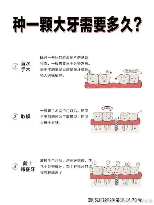 97揭秘种植牙全过程!到底要去几次医院?