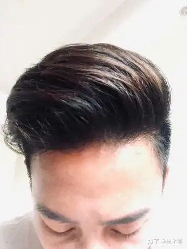 为什么男生留锅盖头有刘海看起来挺帅,刘海掀上去 贼丑?