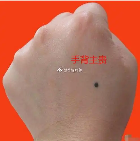 我们都知道手心有痣主富贵,手背有痣的寓意也不差,手背上有痣则表示此
