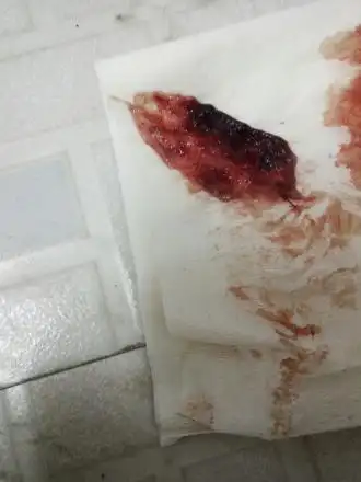 人工授精17天流血像来月经是怀孕了吗"圆梦之家"-第2张图片-星空博客