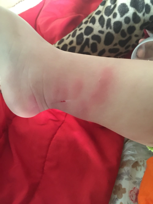 [绵阳妈妈帮]急急急