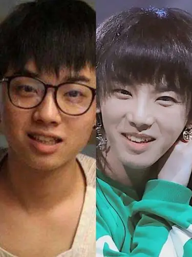 先声明,_圈子-新氧美容整形