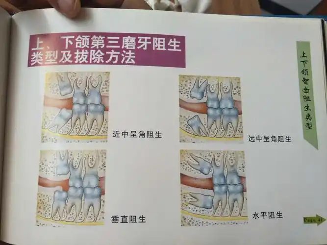 第三磨牙 (8) 100-500元/个