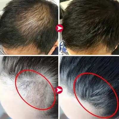 博倩育发液防增长头皮护理发根营养液女生眉毛胡子睫毛发膜