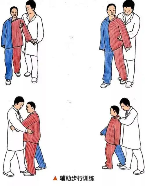 红色表示患侧早期步行需要家属给予辅助步行训练.