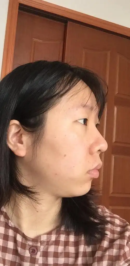 我应该是全组最丑的侧脸和凸嘴了,加个慎入吧