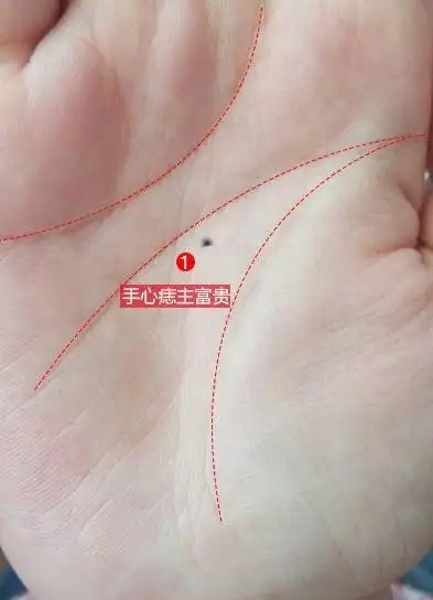 我记得以前写文章写到过,不论是先天的手心痣,还是后天的痣,都是大吉