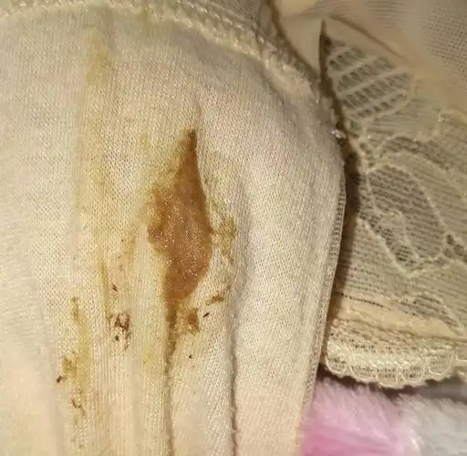 孕五周,一直从怀孕就流这种分泌物,怎么回事?