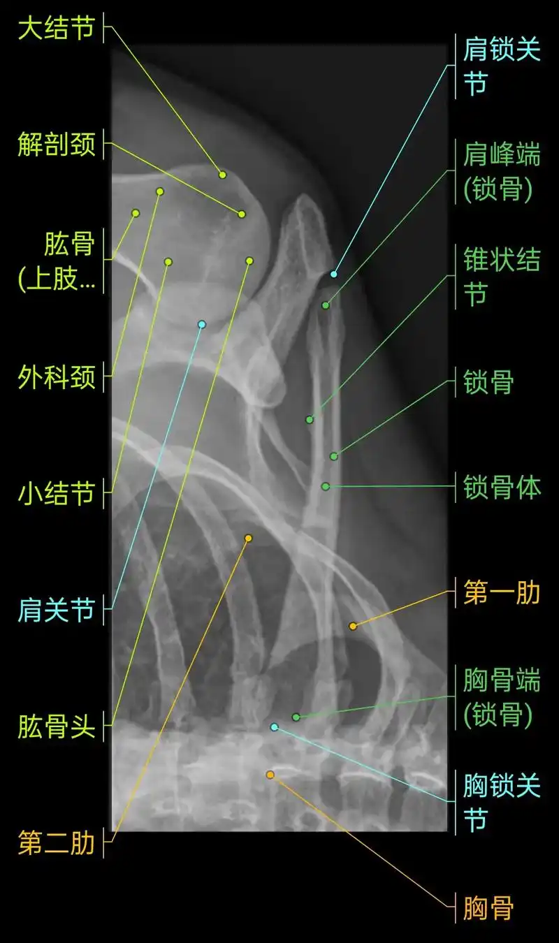 肩关节x线图解!#放射科 #医学影像 #医学科普 #骨科 # - 抖音