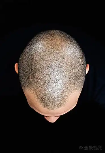 特写_光头_一个_男人_图片大全—全景创意图库(quanjing.