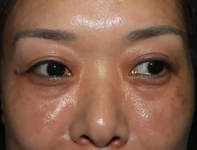 脸部肌肤黯淡无光该怎么办优质