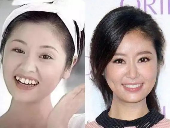 "整牙"堪比"整容",孩子牙齿好看,颜值才有保障,家长别大意