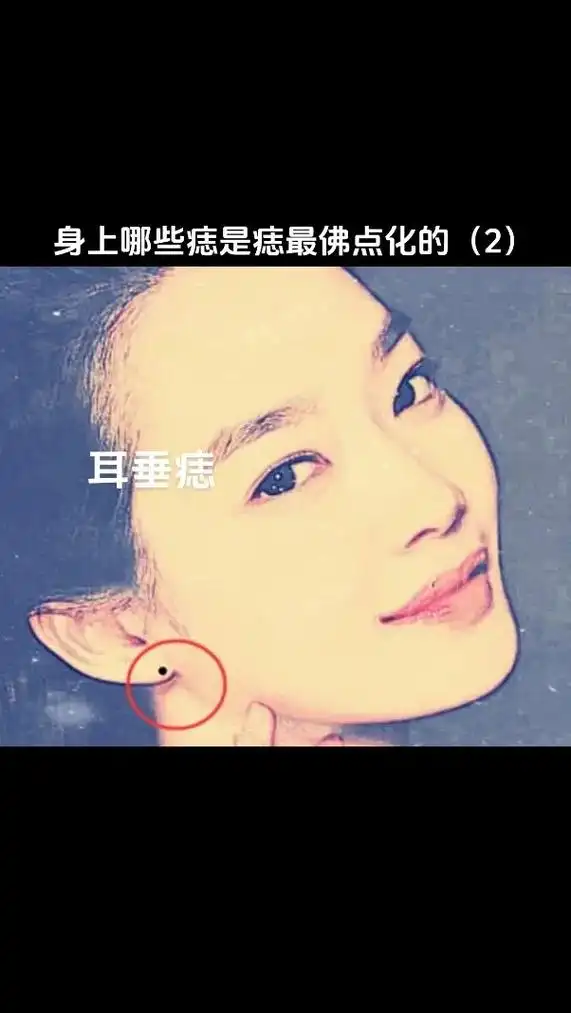 痣 #相由心生 #佛 痣#吉 #福 2,耳垂痣