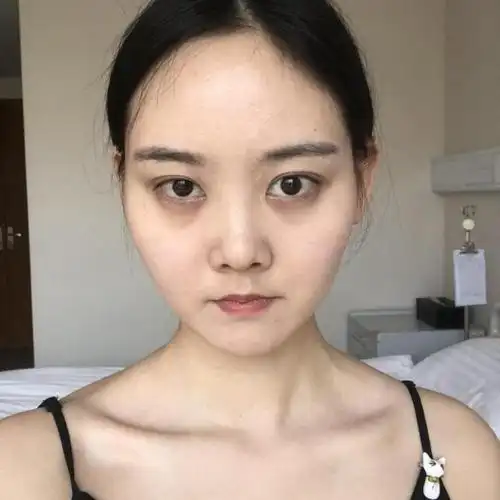 颧骨高,下颌宽,大脸盘子就真的没办法了吗?