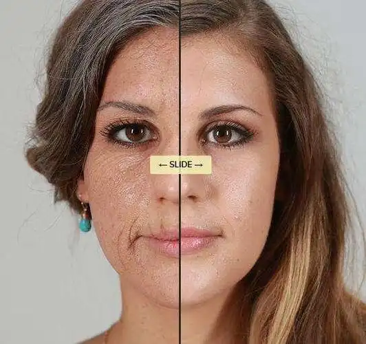 头条问答 - 熬夜重度患者如何改善皮肤暗沉?(2个回答)