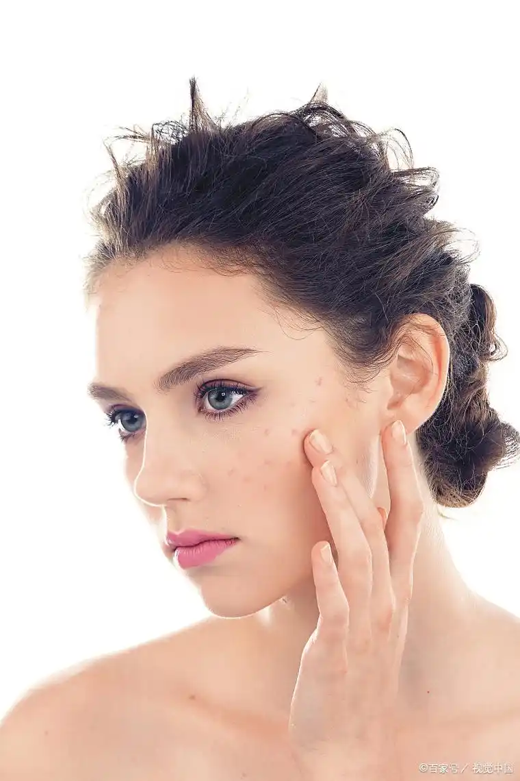 敏感皮肤,形成的原因有哪些?教您,敏感肌,如何护肤?