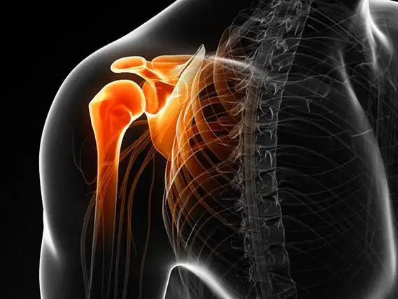 我是上海六院运动医学科主任医师赵金忠,关于肩关节疼痛,活动受限等