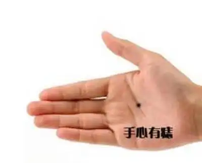 手相学讲解手上的痣
