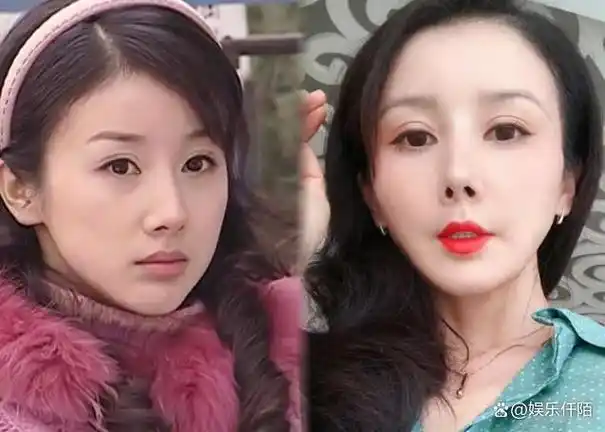 年轻时倾国倾城到中年大变样的六位女星脸僵浮肿憔悴