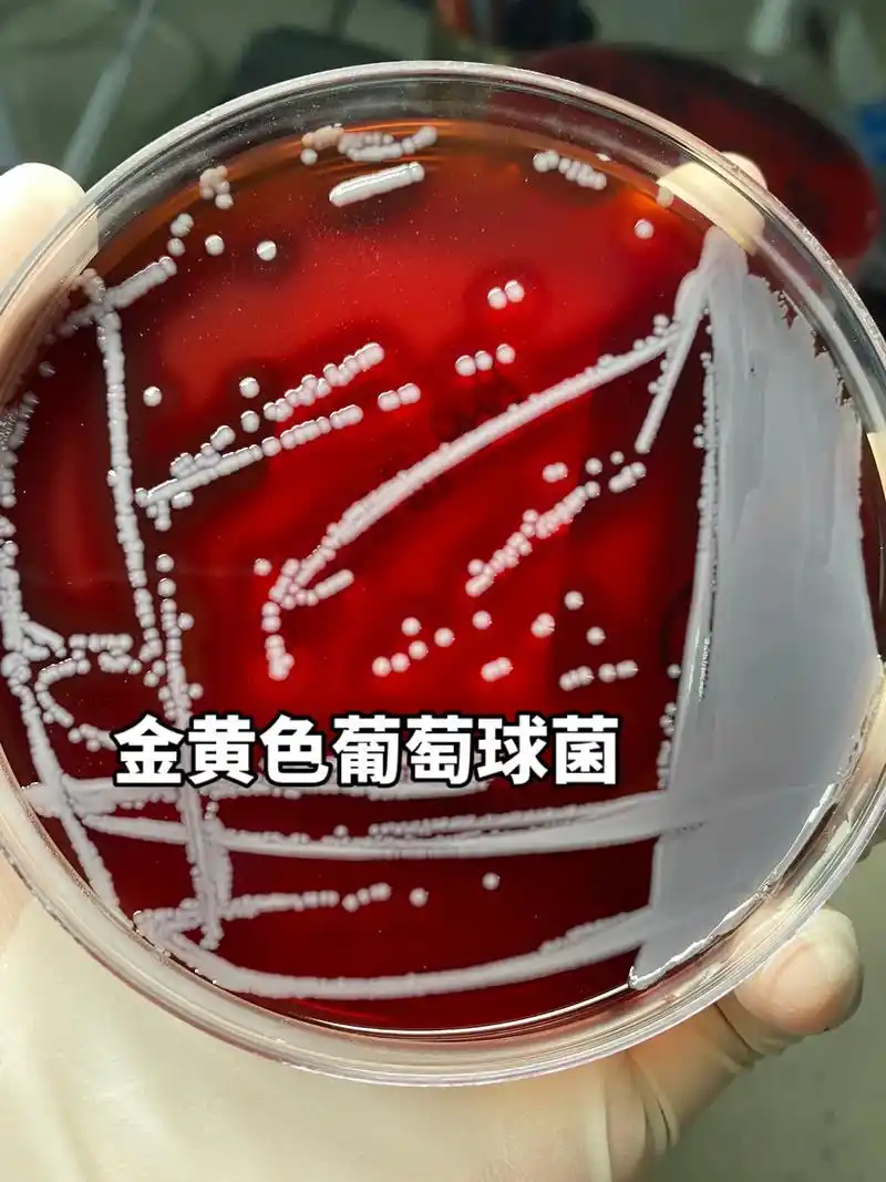 金黄色葡萄球菌