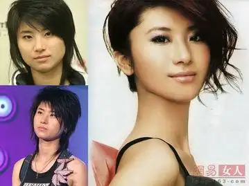 尚雯婕整容了吗?尚雯婕整容前后照片 大饼脸变瓜子脸