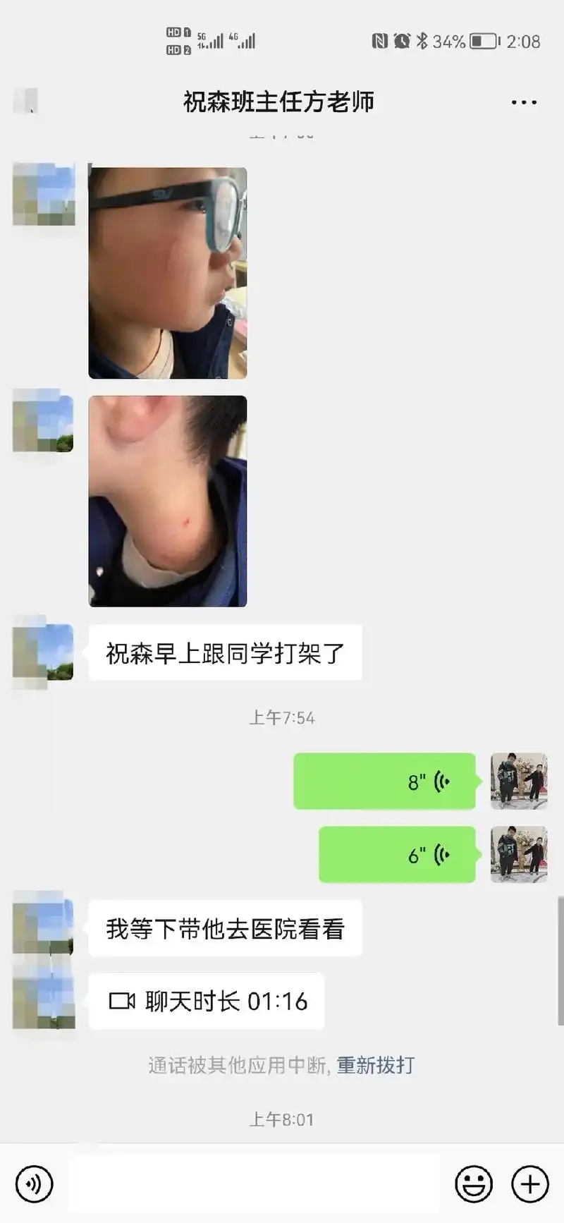 一直很内向的小家伙今天早上在宿舍跟同学打架,被同学