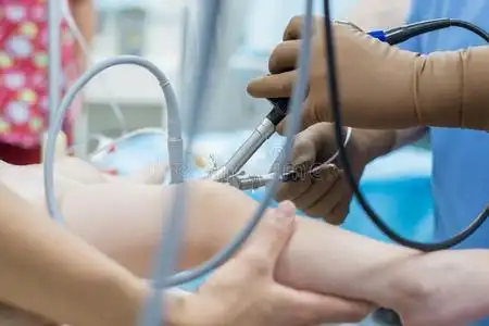 一队关于泌尿科医师医生表演的一膀胱镜检查使用一囊肿照片