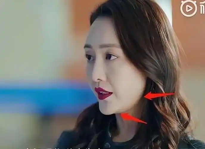 下巴角度更加尖锐后,使王鸥整个人看起来,有种不太讨喜的世俗精明感.