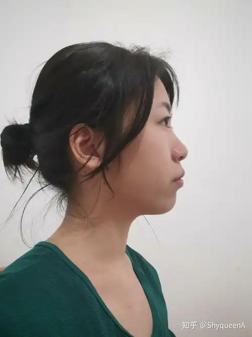 侧脸很平啊 怎么办啊 感觉脸就是一条线下去了 特