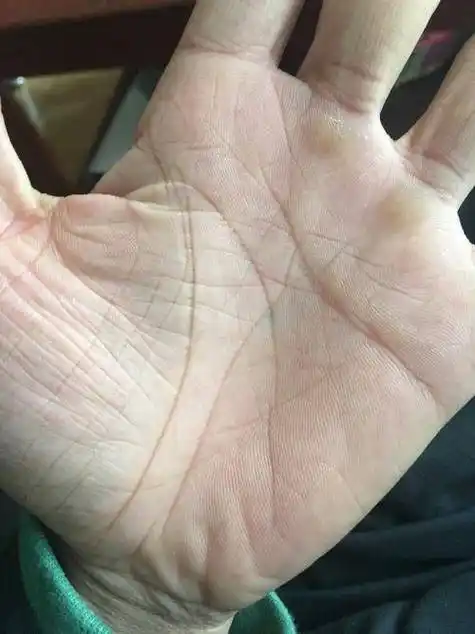 (10)生命线的末端起太大叉纹的人,暗示中年以后的运气较弱,所以在青年