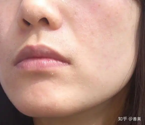 本人干皮,想知道你们早晚怎么护肤? - 知乎